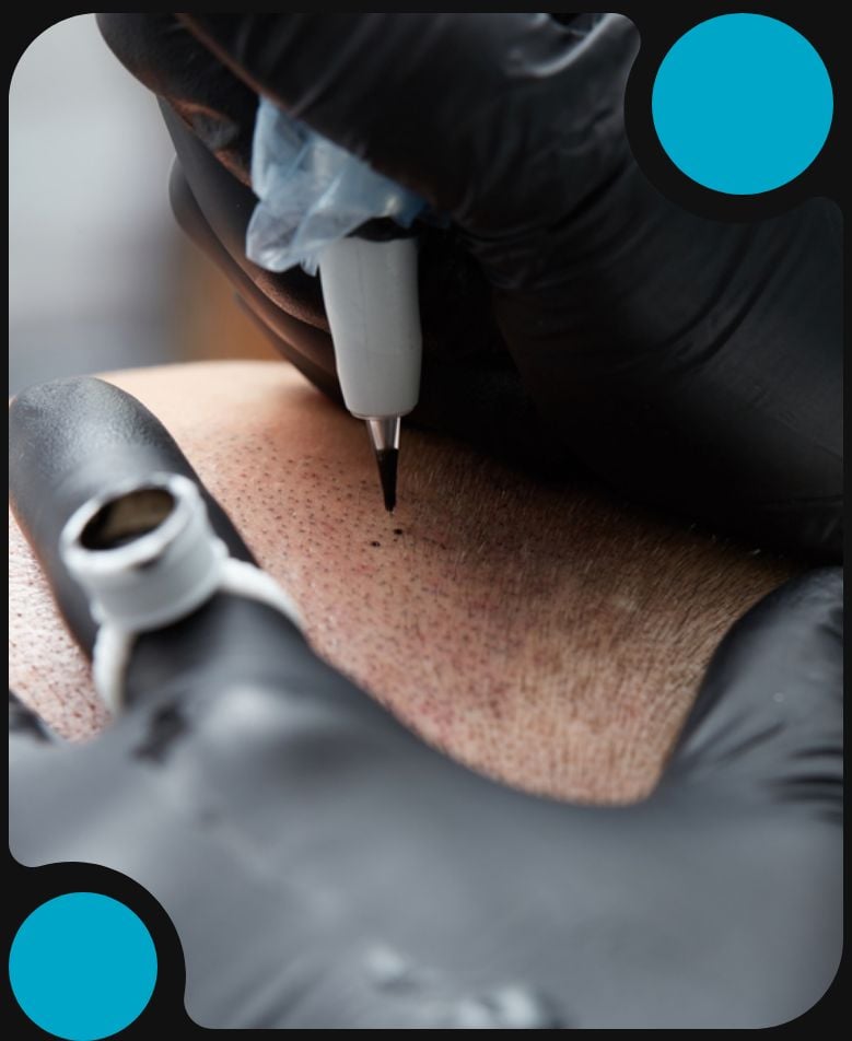 Scalp-Micropigmentation-Services