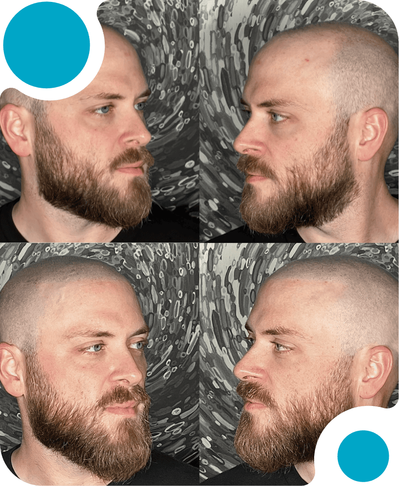 Hair Solutions