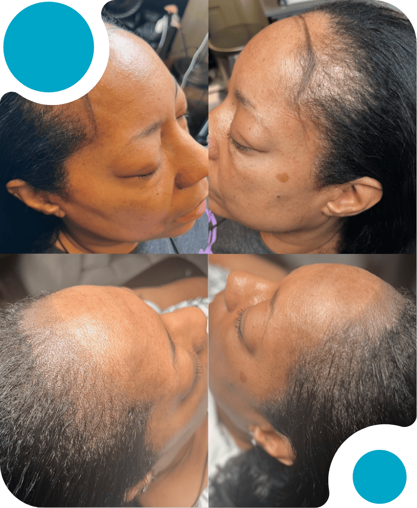 Hair Solutions