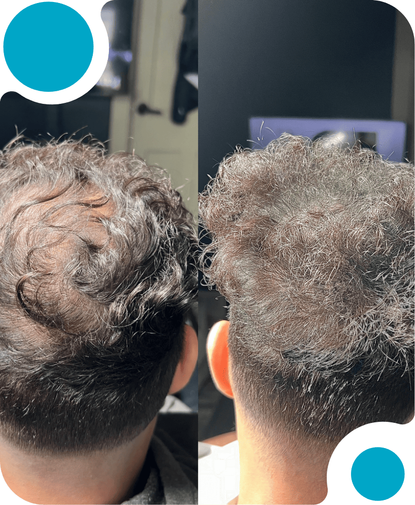 Hair Solutions